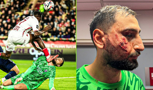 น่าหวาดเสียว! ดอนนารุมม่า หน้าเหวอะโดนสตั๊ดย่ำ